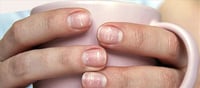 Nails White Spots: Why do white spots appear on nails..